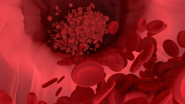 Red Cell Distribution Width (RDW) Blood Test: Importance, Conditions ...